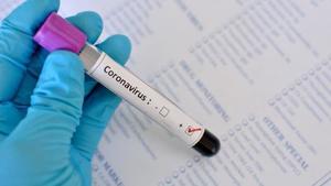 Coronavirus Message from Dr. Miller